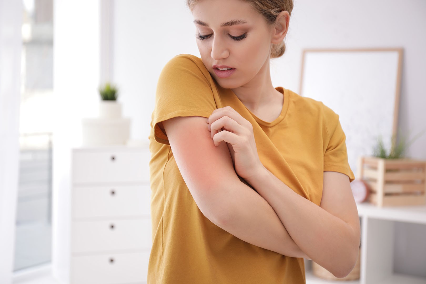 5 Faktor Penyebab Munculnya Alergi yang Perlu Anda Waspadai
